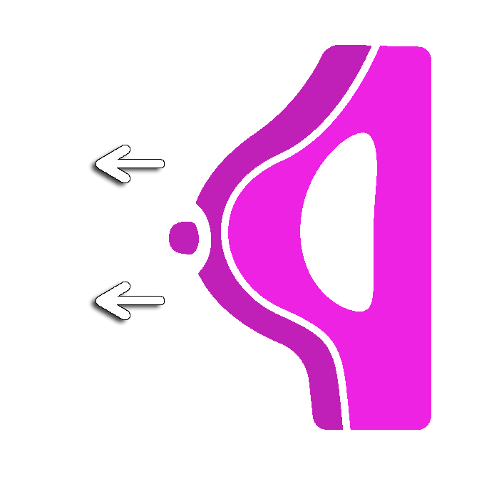 เสริมหน้าอก