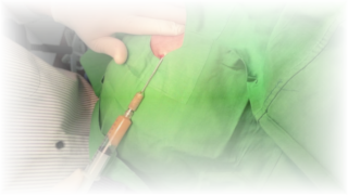 ปัญหาจากการฉีดฟิลเลอร์